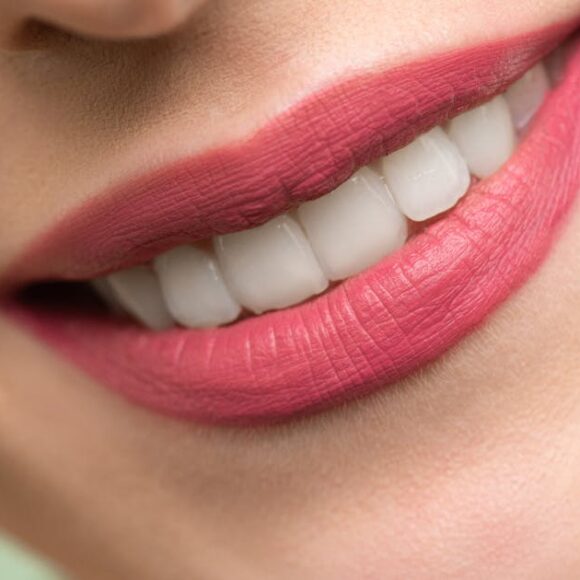 Blanqueamiento dental profesional en Zamora: resultados seguros y duraderos